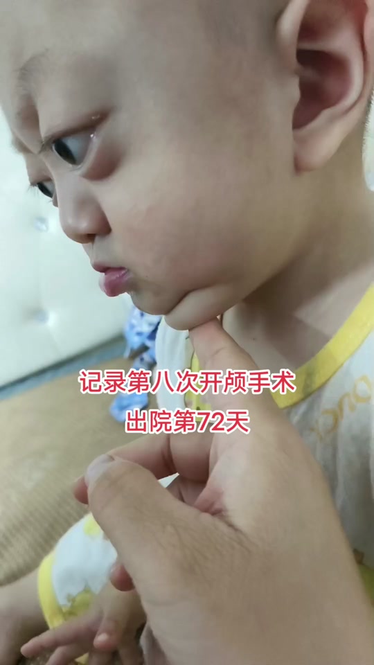 克鲁宗综合征李亚鹏_克鲁宗综合征!_克鲁宗综合征中国人 - 抖音