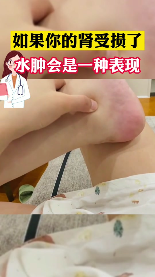 小腿一按一个小坑怎么回事 - 抖音