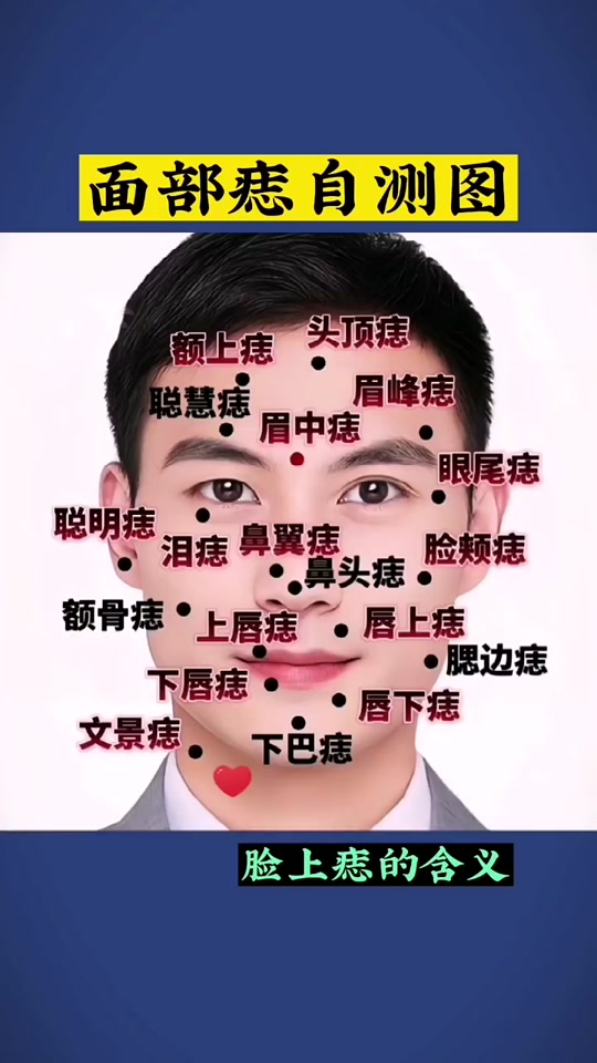 面痣分布图和含义_面痣的位置与命运图解_面痣 全图 - 抖音