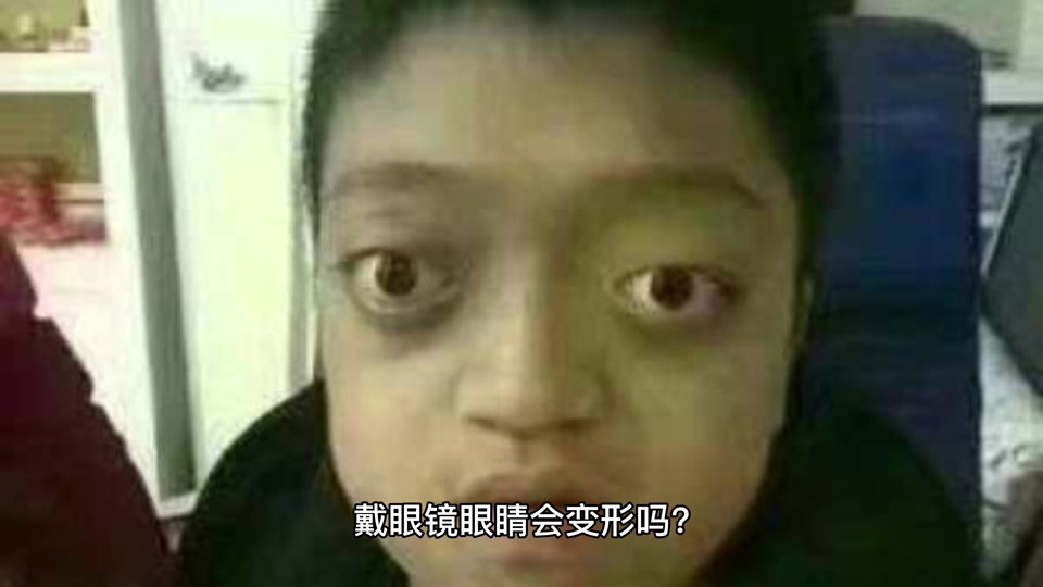 戴眼镜眼睛变形凹陷对比图 - 抖音