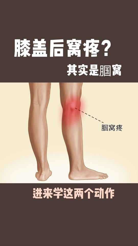 游完泳膝盖后面的腿窝筋疼怎么回事 - 抖音