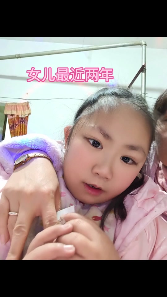 歌舞伎综合症宝宝照_歌舞伎综合症患儿寿命_歌舞伎综合症长什么样