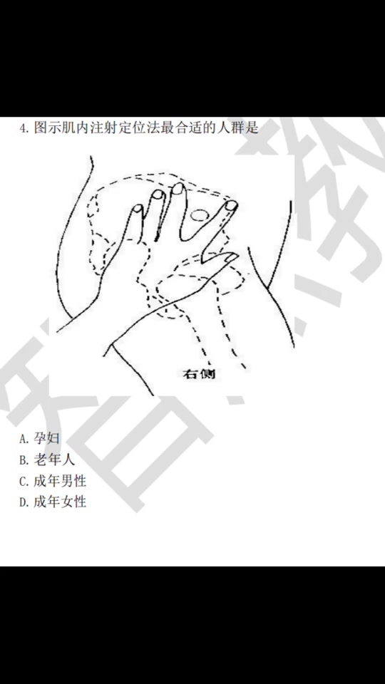 肌肉注射部位定位法_肌肉注射部位有硬结怎么办