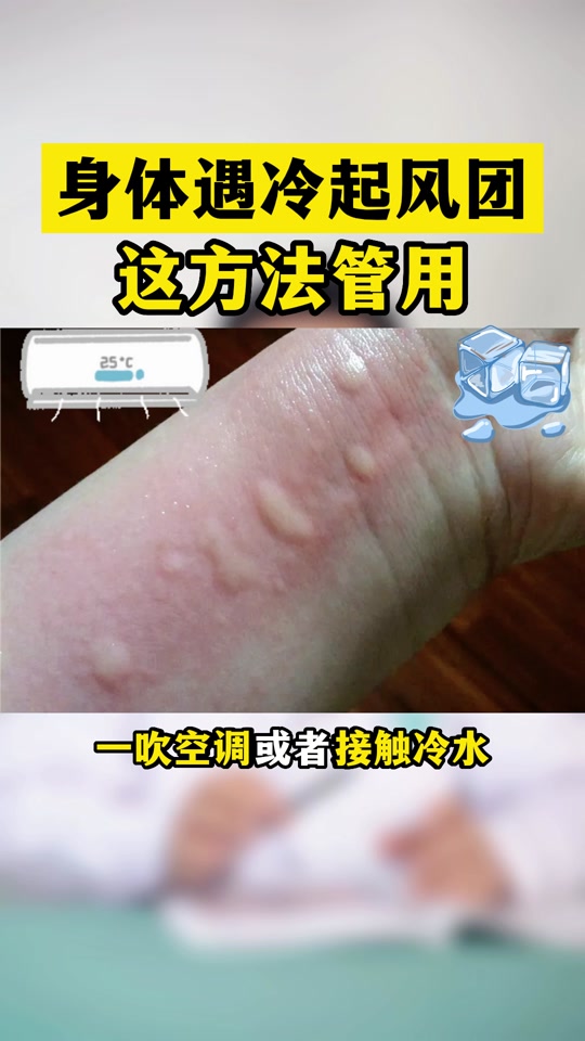 吹空调身上起疙瘩很痒 - 抖音