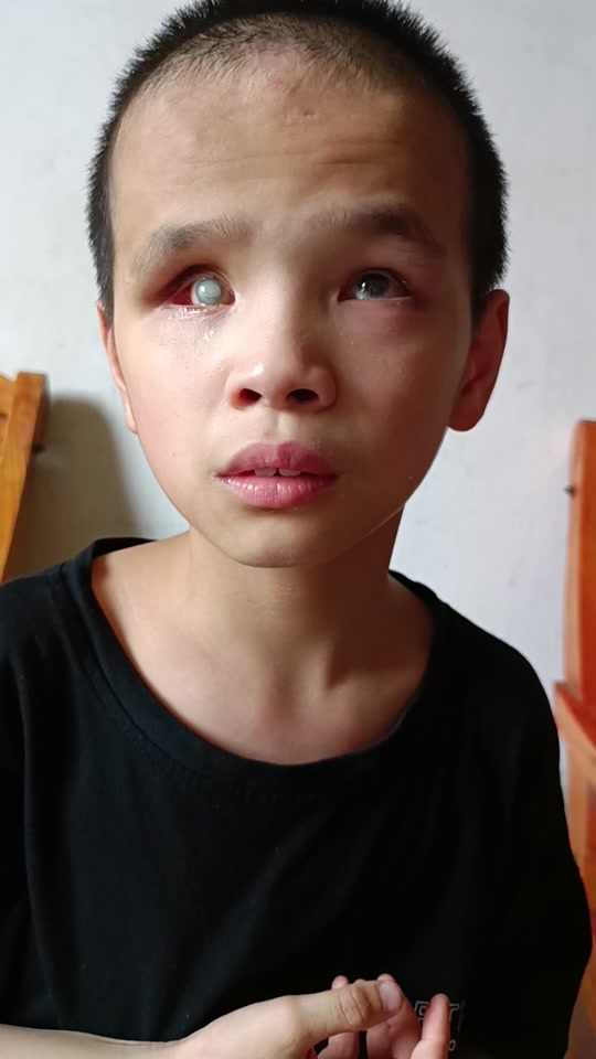 碰是家常便饭,看不见就慢慢走吧,人生路还很长,还愿人间能善待你#盲人