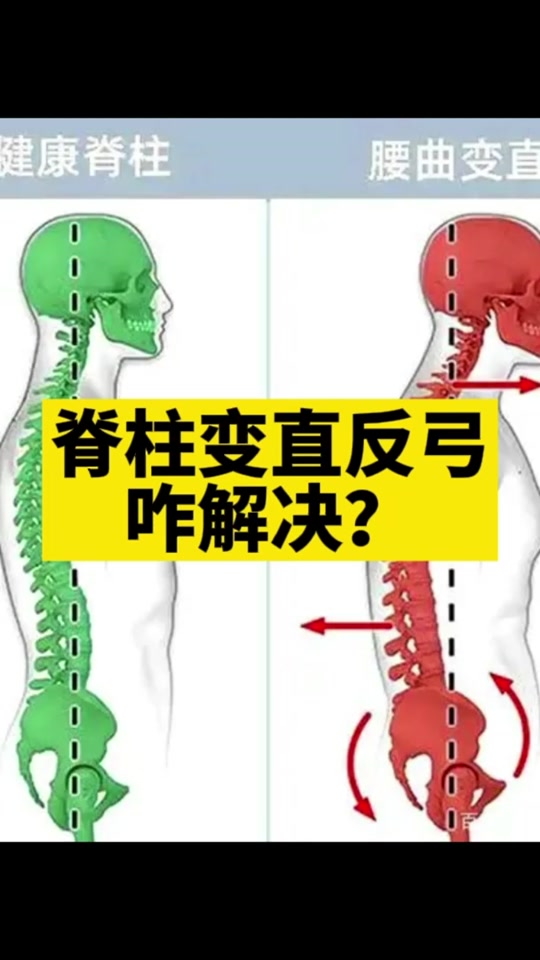 片段弓矫正