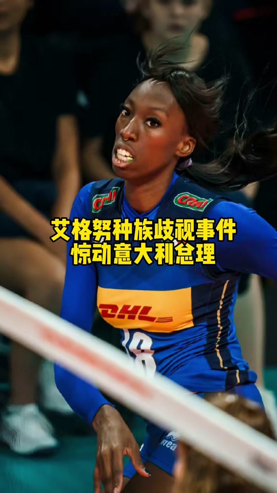 艾格努头发为什么是直的 - 抖音