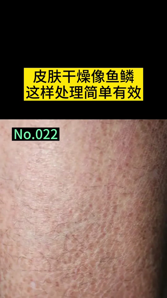 蛇皮肤鱼鳞皮肤