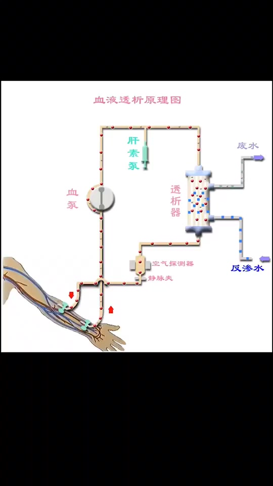 肾透析的原理动画演示