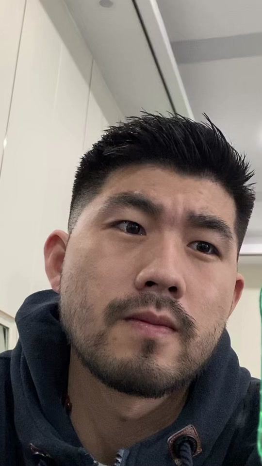 发际线太低对颜值的影响