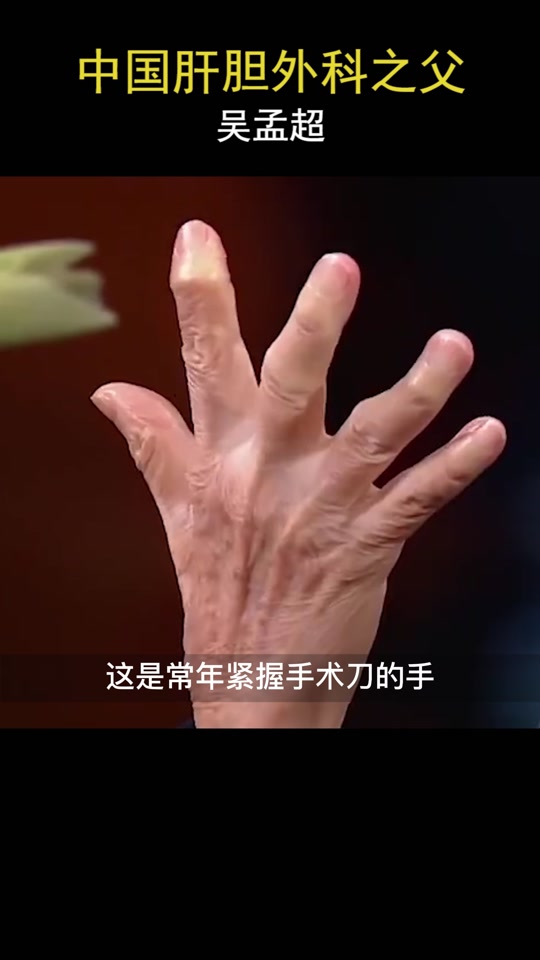 吴孟超生前珍贵画面