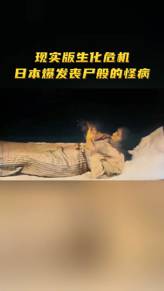 新知:日本出现如同丧尸般的怪病?日本水俣病的灾害或将持续存在!