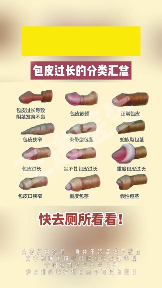 包皮过长定义