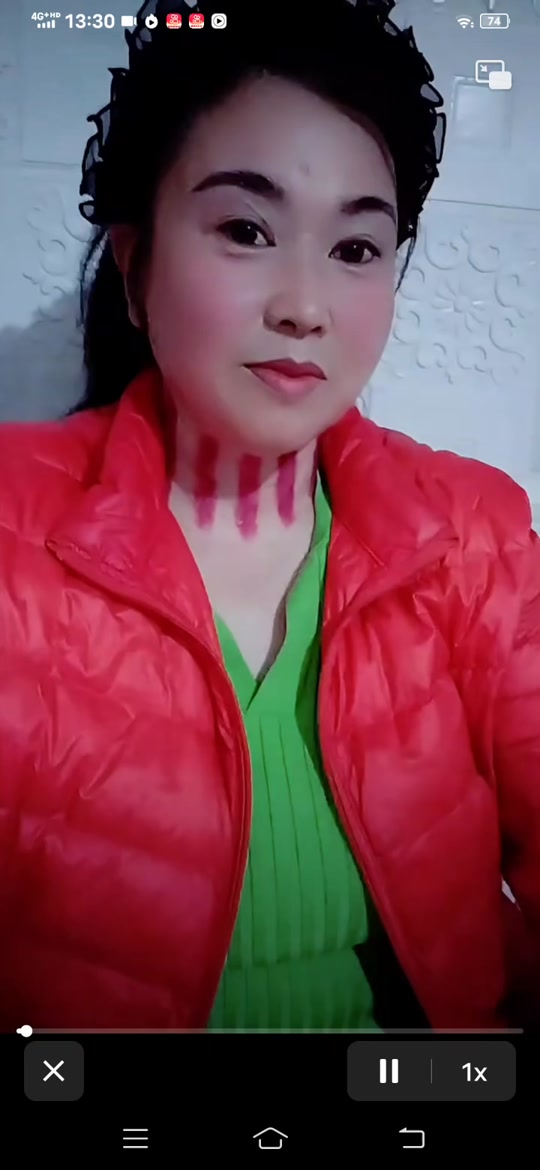 美女新年揪痧_美女揪痧完整