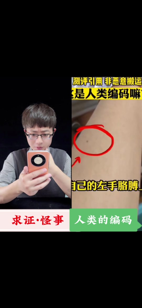 手臂有痣图解对照表 - 抖音