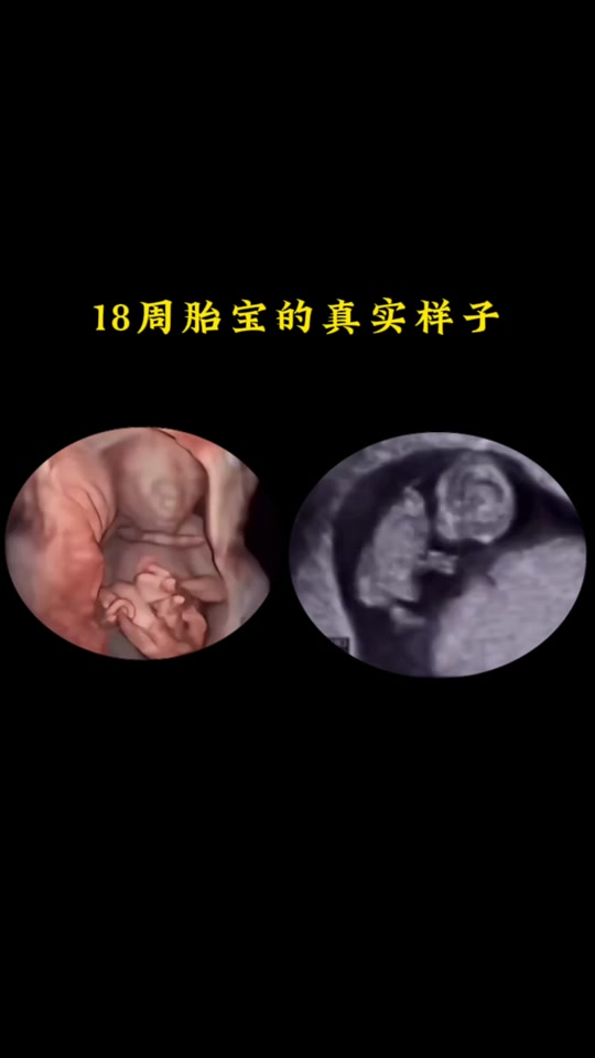 24周宝宝肚子里的样子