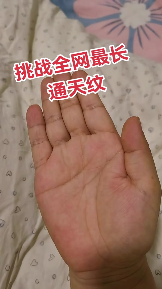 额头通天纹和天柱纹区别