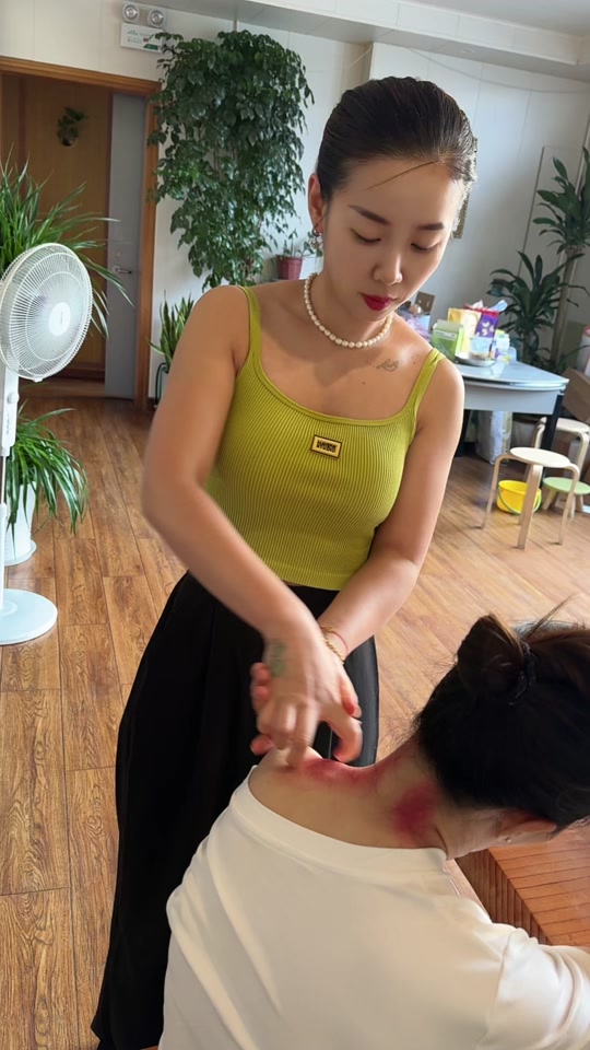 永康揪痧女