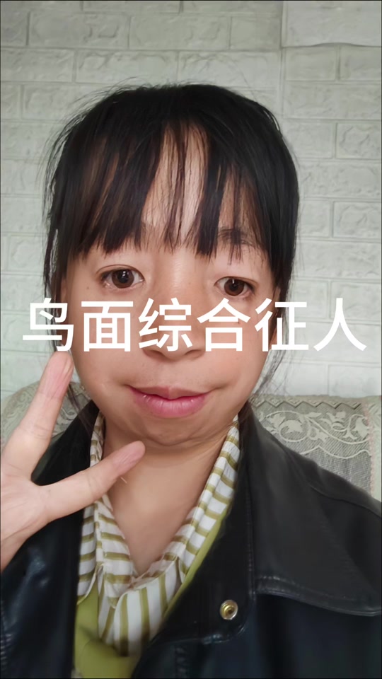 鸟面综合征博主