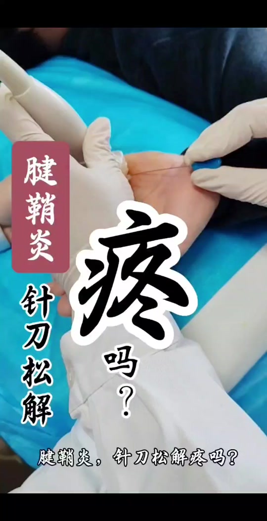 腱鞘炎小针刀3d演示
