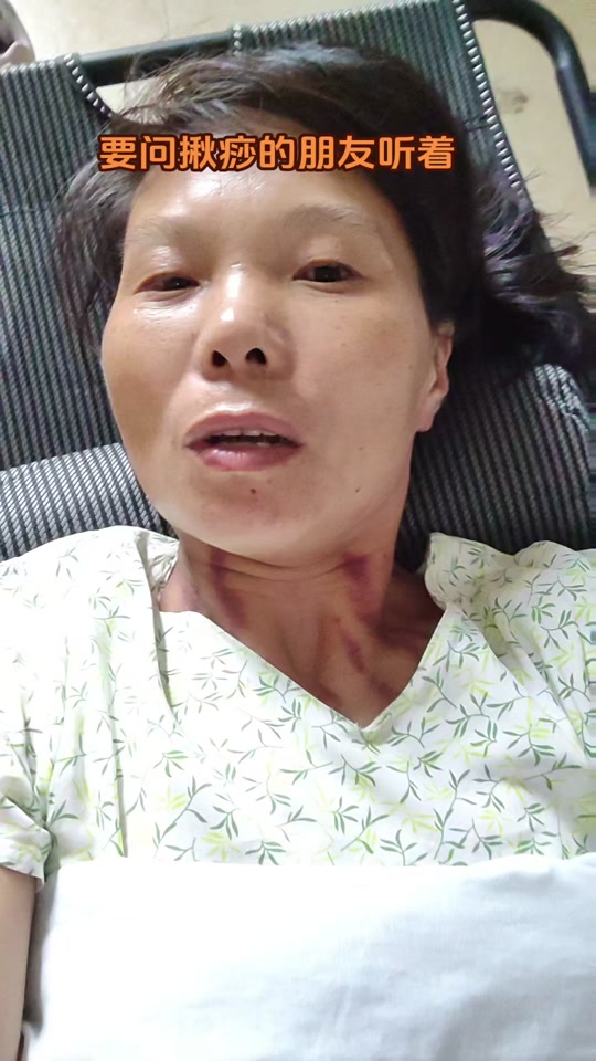 我的揪痧情缘_我的揪痧曰记_揪痧情深散文 - 抖音