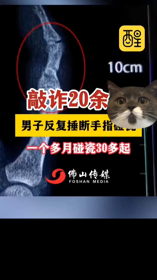 拍抖音碰瓷=抖音上碰瓷宝马的视频