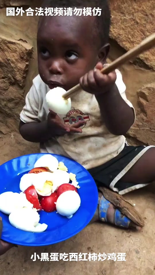 非洲黑蛋小孩
