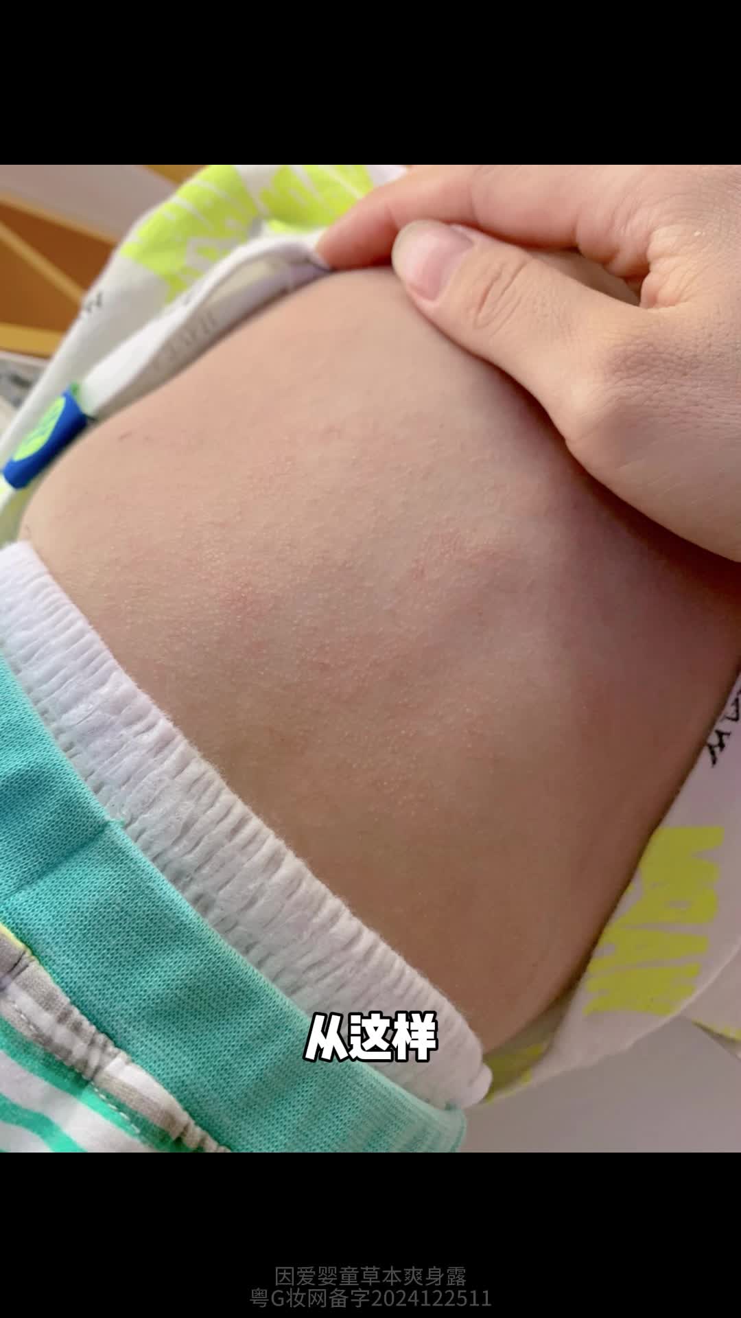 宝妈们,千万别等宝宝身上起白屑难受了才开始用这个#宝宝爽身露,哪里