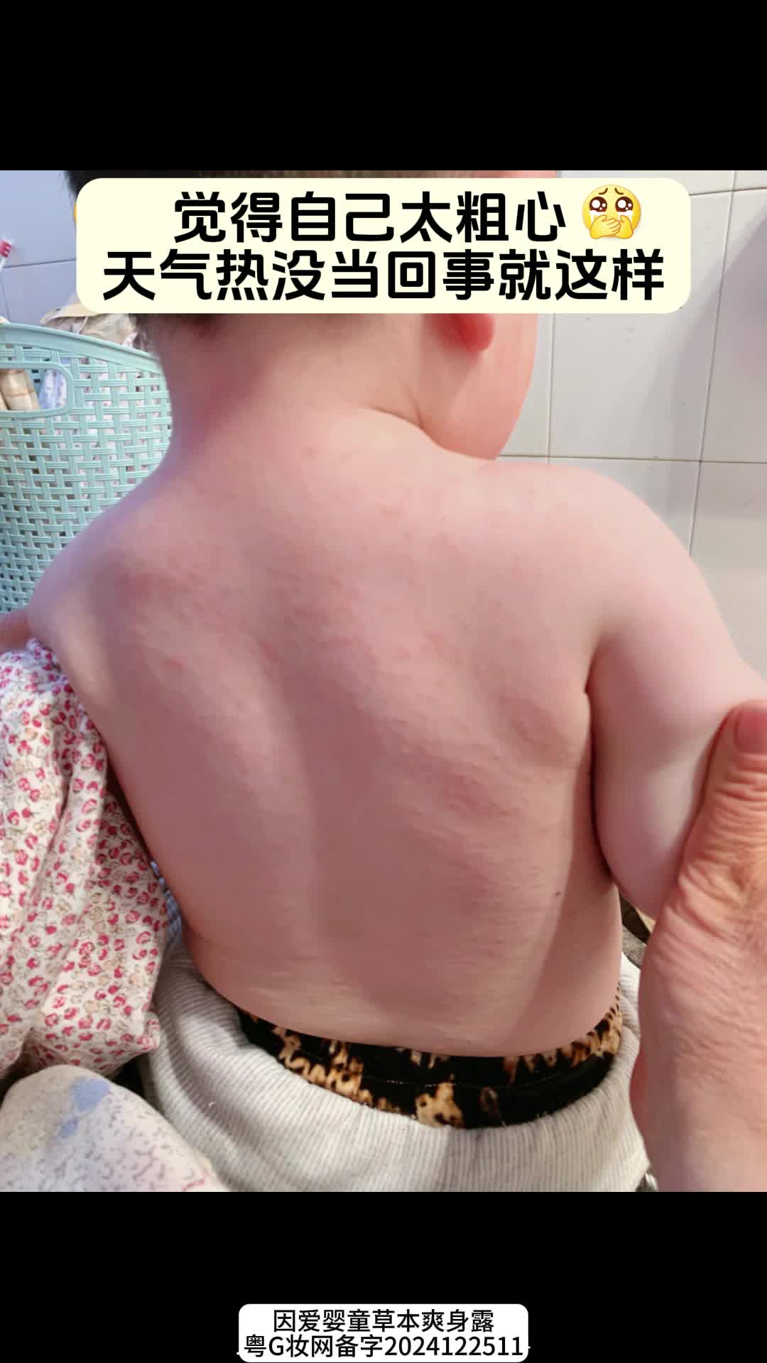 真后悔没有早点知道这款 ,宝宝出门热得一直抓挠,都是红点点,一定要