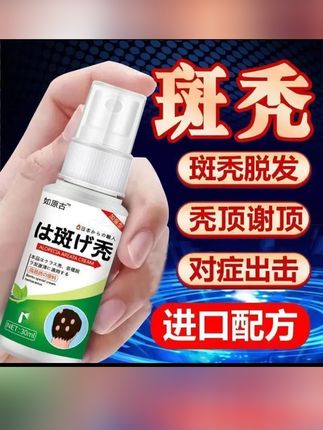 斑秃鬼剃头严重掉发秃顶突发性斑秃非瘢痕性突发成片脱发#好东西一起分享