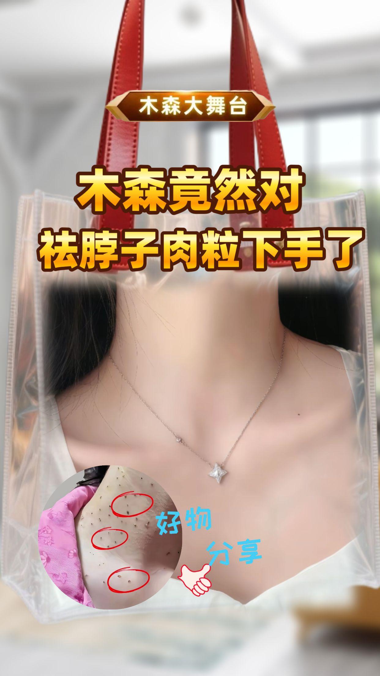 #木森 #木森大舞台 #小肉粒 #好物种草 #脖子上的小肉粒