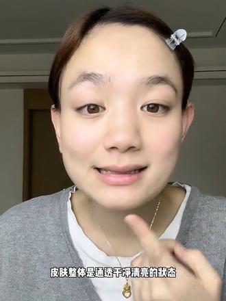 第三代#羽素闭口水 保湿舒缓细毛孔湿敷控油爽肤水湿敷水化妆水#羽素闭口水测评 #羽素湿敷水 #闭口水 #去闭口