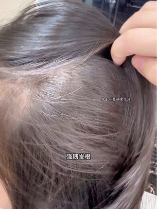 孩子头发变油变臭头屑多,多半是洗发水没用对!一定要早点换成这个#英氏黑宝瓶洗发水 从头皮开始养护,洗完蓬松顺滑好几天!#洗发水推荐#