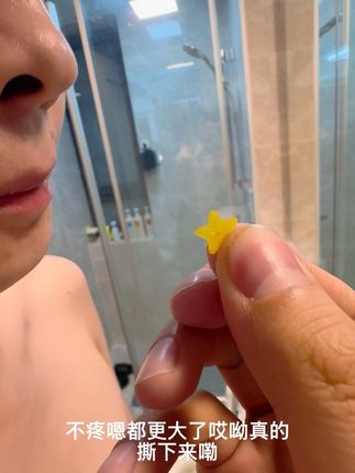 #日常生活 真的有用,贴了睡了一觉,真的把痘痘撕下来了