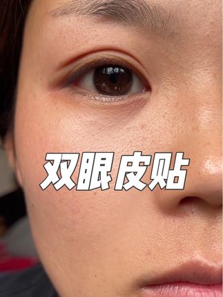 #双眼皮贴 #内双肿眼泡 #美妆好物