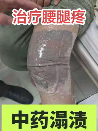 治疗腰腿疼的方法,中药溻渍#保守治疗方法 #中药养生#腰腿疼怎么办 #中药养生 #抖音健康使用计划