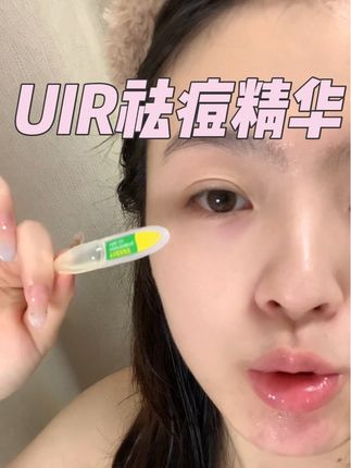 只有老痘肌才懂它的含金量啊!反反复复的印子坑子一定不要错过!!!#uir祛痘精华 #痘痘 #痘肌 #痘痘逆袭之路 #护肤分享