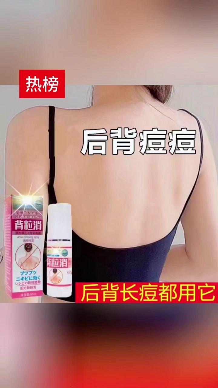 拒绝不了!姐妹们,快来试试这个背粒消喷雾!#背粒消 #喷雾 #赵露思 #赵露思推荐 #赵露思好物推荐