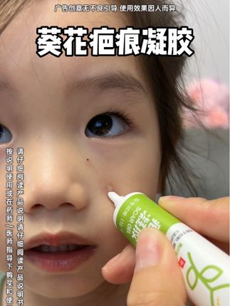 孩子磕磕碰碰留黑印,这个东西真的备上#开学季#宝宝磕碰#葵花#疤痕凝胶 #宝妈推荐