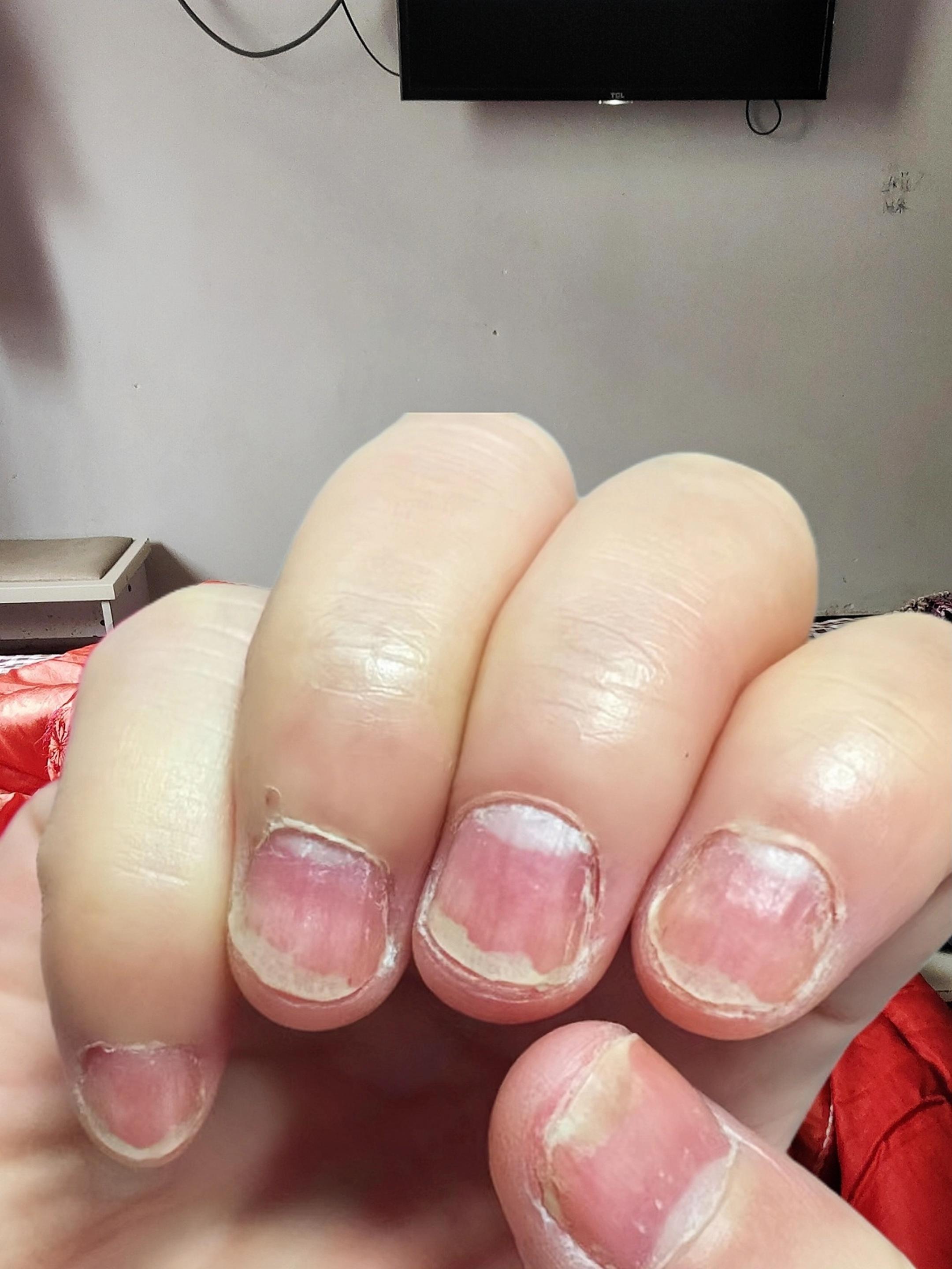#强烈推荐 #指甲 #脚指甲 #日常分享 #指甲盖