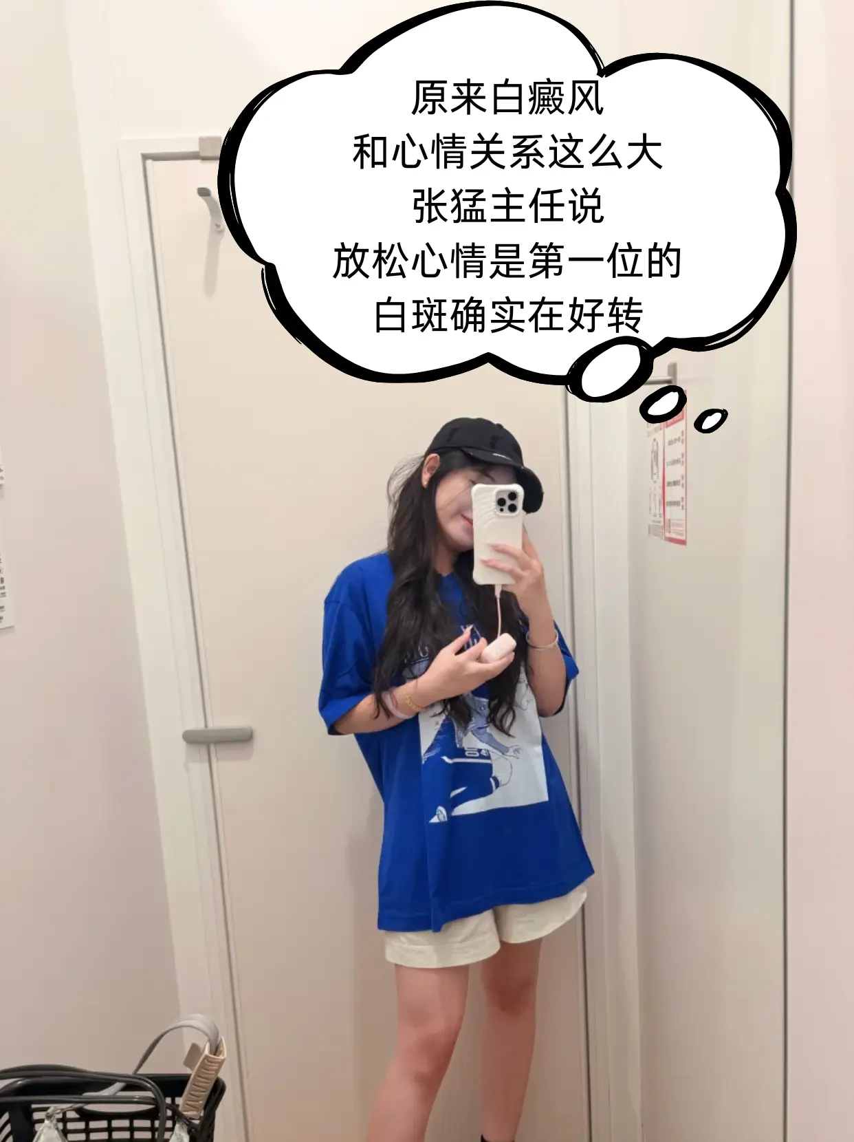 原来心情好了,白斑真的会退 以前总觉得是皮肤问题,后来才发现 - 抖音