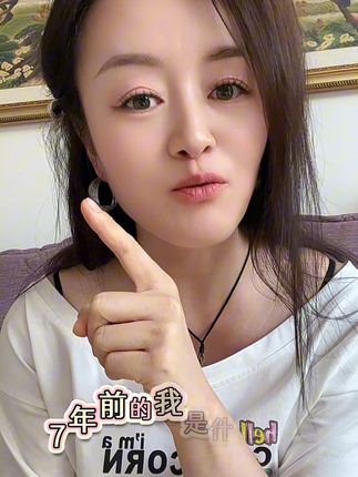 #好皮肤养出来 #自用好物推荐 以前的我让我好自卑