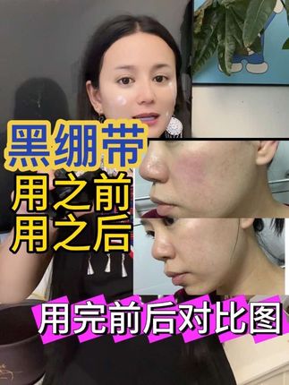 无限回购的好用面霜,脸变紧致就信它#自用好物分享 #好物推荐🔥 #黑绷带 #面霜 #超级便宜划算