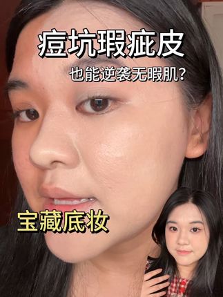痘坑瑕疵皮宝藏底妆!轻松get无暇肌! 谢谢@旦旦有痘坑 小姐姐的分享~爱你❤️,#佑依哇塞粉底液 #ue佑依 #粉底液推荐 #痘坑 #平价好物