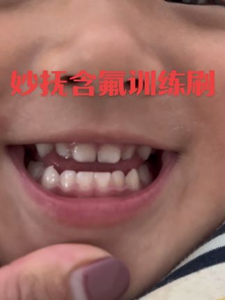 宝宝刷牙又不会吐水,不给他刷牙齿黄黄的,容易滋生细菌,这款牙刷不仅颜值好看还不用牙膏哟宝宝喜欢的颜值也会喜欢刷牙给宝宝的小牙齿洗洗澡吧#妙抚 #妙抚牙刷 #宝妈推荐 #牙刷 宝宝用的软毛牙刷