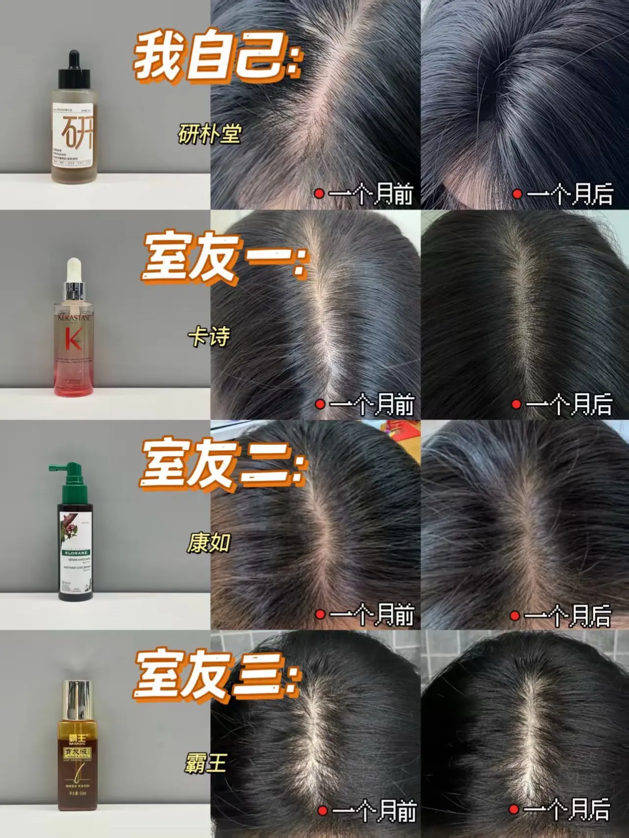 穷鬼经验分享,熬夜掉发还得这样选。#育发液#掉发脱发很严重怎 - 抖音