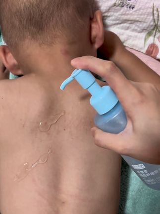 天气越来越热了,快给宝宝换成这种#百草妈咪 液体的爽身露,凝露质地冰冰凉凉的,添加了积雪草,桃叶等植萃精华,还不用担心飞粉问题#母婴好物#夏季必备#宝妈推荐