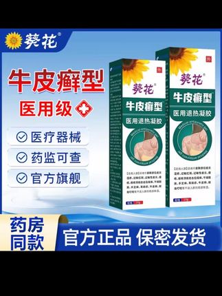 长了牛皮癣真的很难受,但千万别抠,就用葵花牌牛皮癣退热凝胶#牛皮癣 #股癣 #手癣 #足癣 #体癣