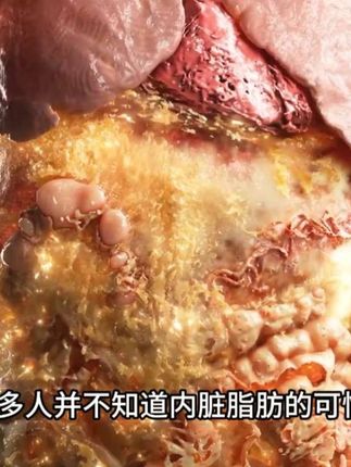如果你也有啤酒肚那一定要看完这期视频!#啤酒肚 #运动 #自律 #健身 #科普