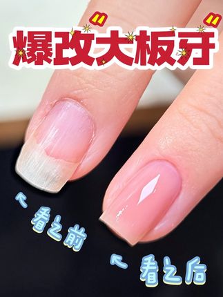 爆改丑指甲!#美甲💅 #美甲分享 #超好看的美甲 #美甲教程分享